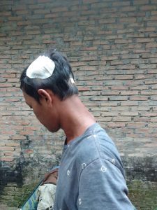 Sebulan Dilaporkan, Kasus Penganiayaan di Polsek Tanjung Pura Mangkrak